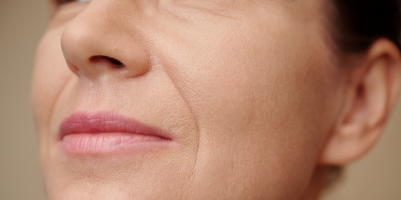 The Overlooked Reason Why Lips Lose Volume After 40